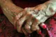 Hands of an elderly resident at a nursing home
