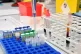 Medical urine samples and blood vials in a medical clinical laboratory, based at University of Bristol, Monday April 8, 2019