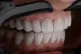 Teeth [Pic: Kamal Hoseinianzade / Creative Commons]
