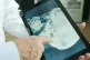 X-ray scan displayed on tablet