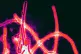 Ebola virus