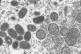 An electron microscope image of mature, oval-shaped monkeypo