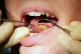 A dentist at work, May 19, 2011