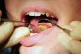 A dentist at work, as dental hygienists could be granted the